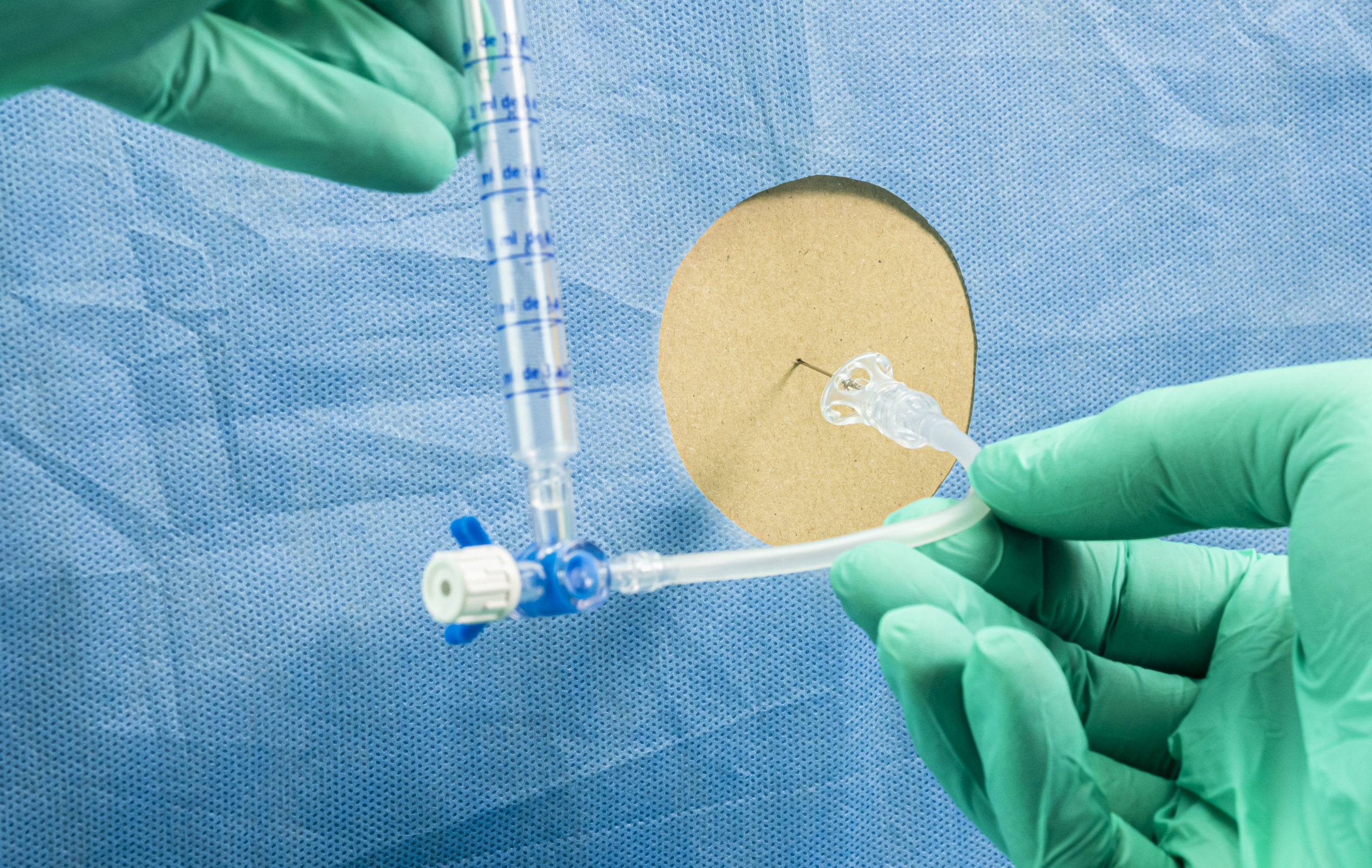 Person affected with Transverse Myelitis after being injected by Oxford Covid-19 experimental vaccine, physician extracts cerebrospinal fluid to investigate causes, conceptual image