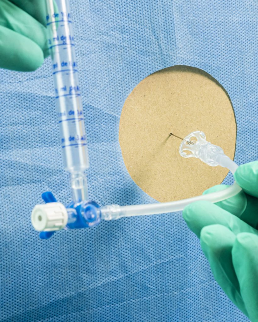 Lumbalpunktion Neurologie Ulm